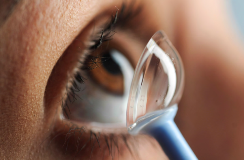 Scleral Contact Lenses Crozet Eye Care